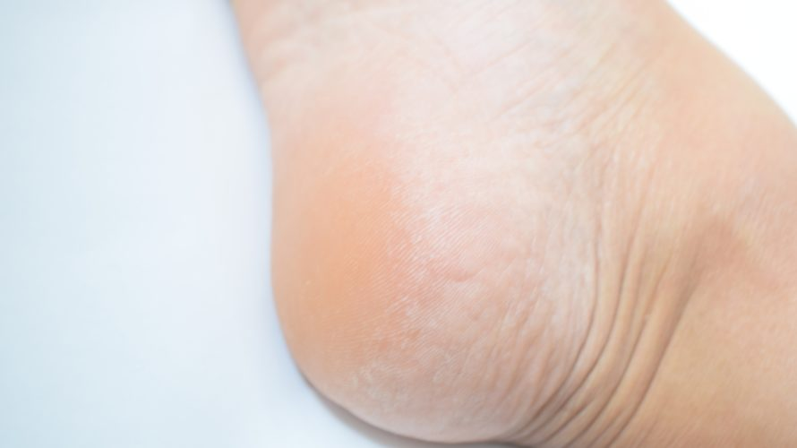 かかときれい　画像